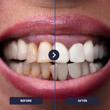 Lade das Bild in den Galerie-Viewer, OrthoVivid 2.0
